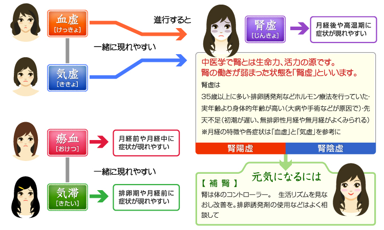 あなたの月経はどのタイプ?