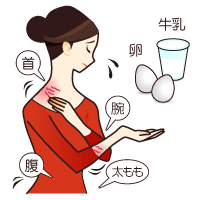 じんましん